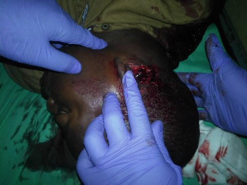 Beni, massacre, attacks, Beni attacks, Beni massacre, Congo ADF