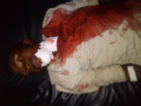 Beni, massacre, attacks, Beni attacks, Beni massacre, Congo ADF